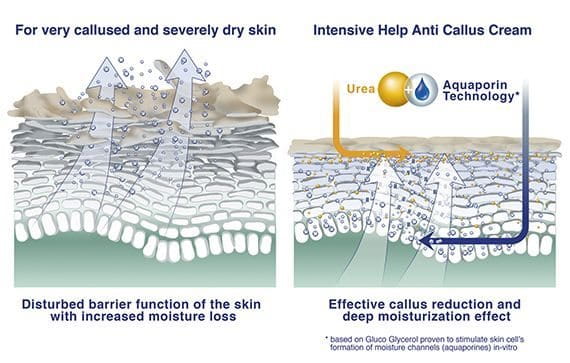 01-detail-anti-callus